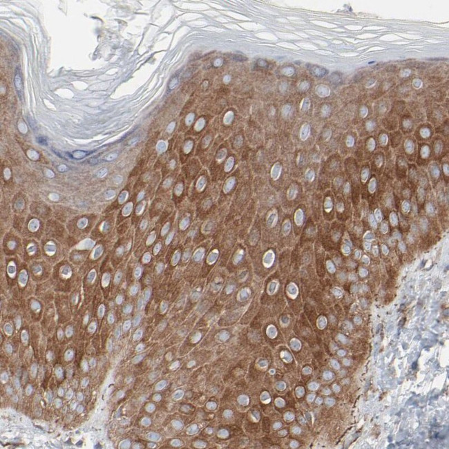 Optineurin Antibody in Immunohistochemistry (IHC)