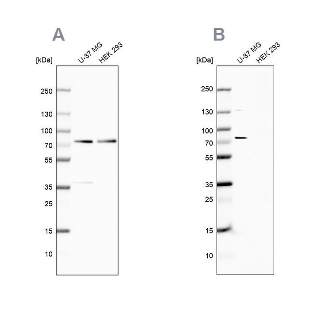 Optineurin Antibody in Western Blot (WB)