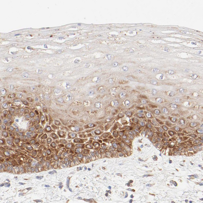 RPS21 Antibody in Immunohistochemistry (IHC)