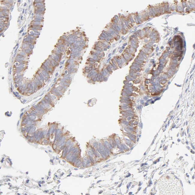 RPS21 Antibody in Immunohistochemistry (IHC)