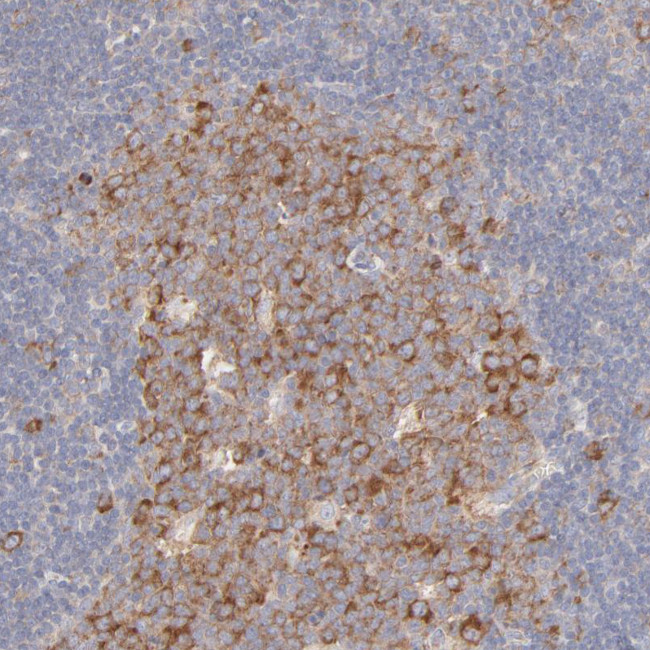 RPS21 Antibody in Immunohistochemistry (IHC)