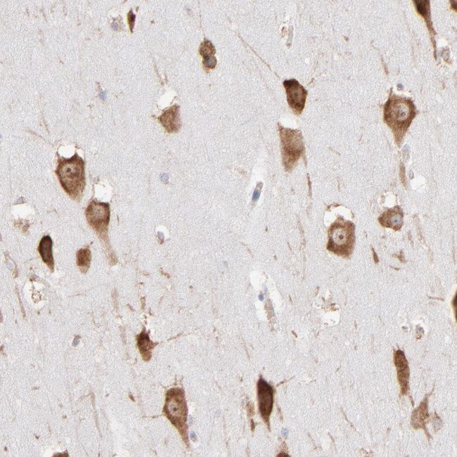 RPL9 Antibody in Immunohistochemistry (IHC)