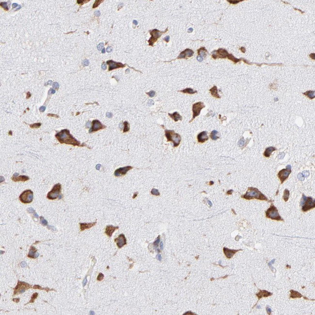 RPL9 Antibody in Immunohistochemistry (IHC)