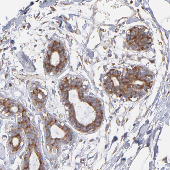 RPL9 Antibody in Immunohistochemistry (IHC)