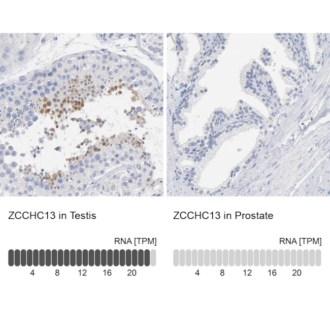 ZCCHC13 Antibody in Immunohistochemistry (IHC)