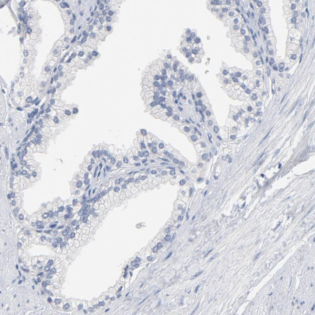 ZCCHC13 Antibody in Immunohistochemistry (IHC)