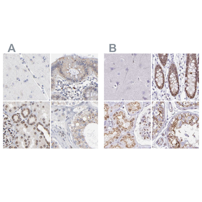 Nesprin 2 Antibody in Immunohistochemistry (IHC)