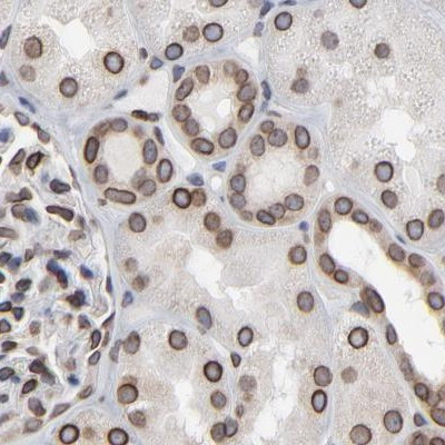 Nesprin 2 Antibody in Immunohistochemistry (IHC)