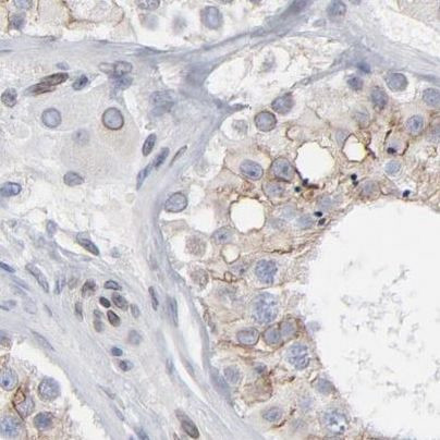 Nesprin 2 Antibody in Immunohistochemistry (IHC)