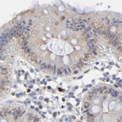 Nesprin 2 Antibody in Immunohistochemistry (IHC)