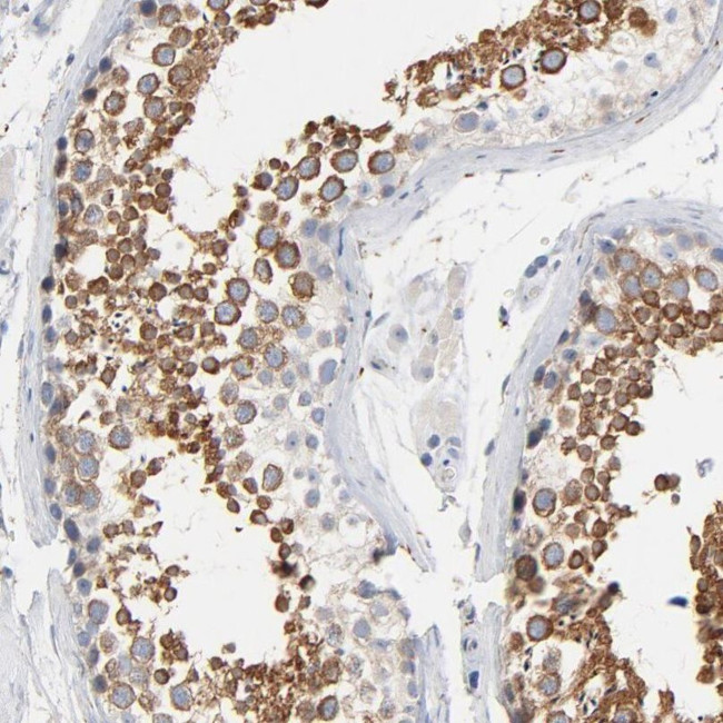 C14orf179 Antibody in Immunohistochemistry (IHC)