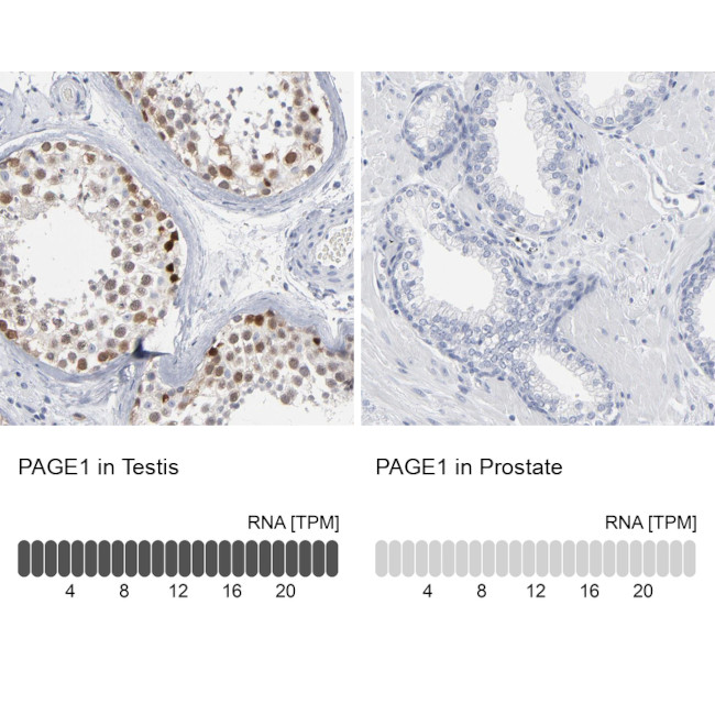 PAGE1 Antibody in Immunohistochemistry (IHC)