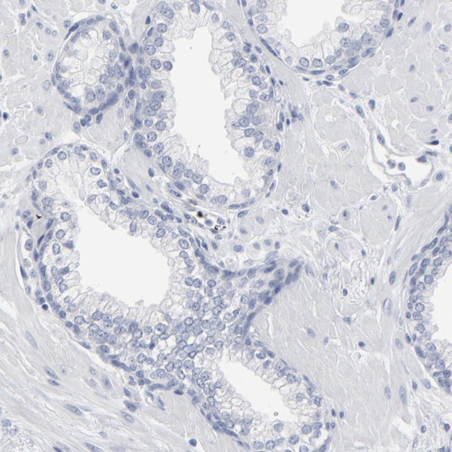 PAGE1 Antibody in Immunohistochemistry (IHC)