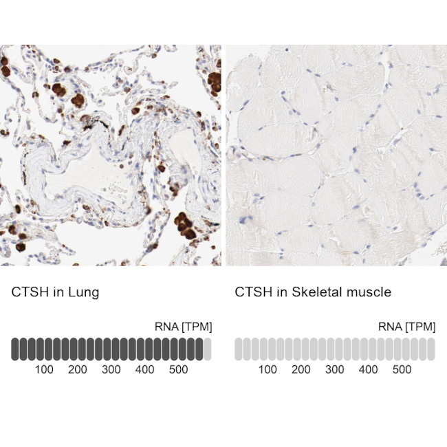 Cathepsin H Antibody in Immunohistochemistry (IHC)