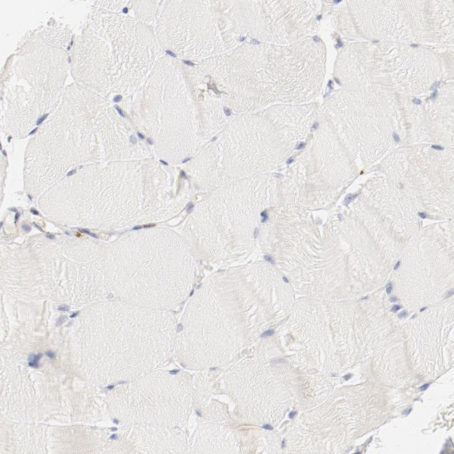 Cathepsin H Antibody in Immunohistochemistry (IHC)