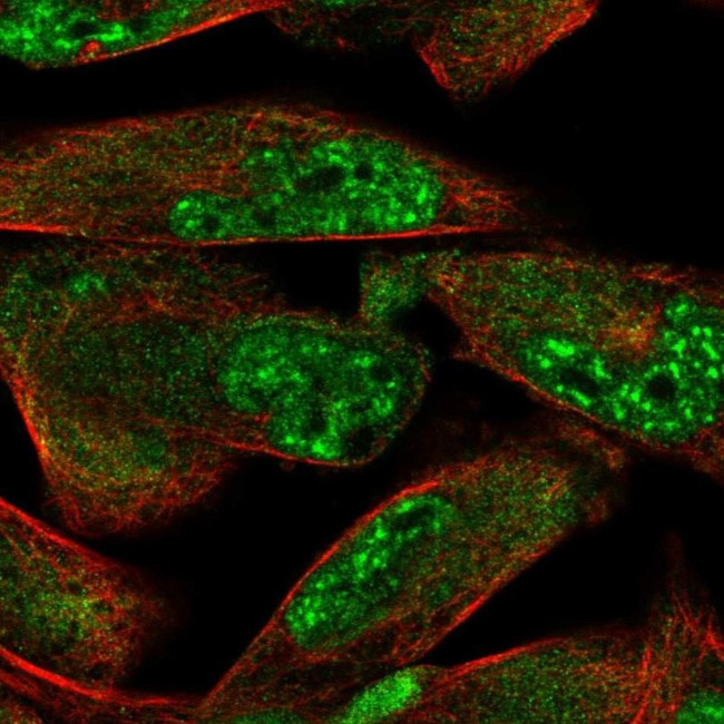 ZDHHC15 Antibody in Immunocytochemistry (ICC/IF)