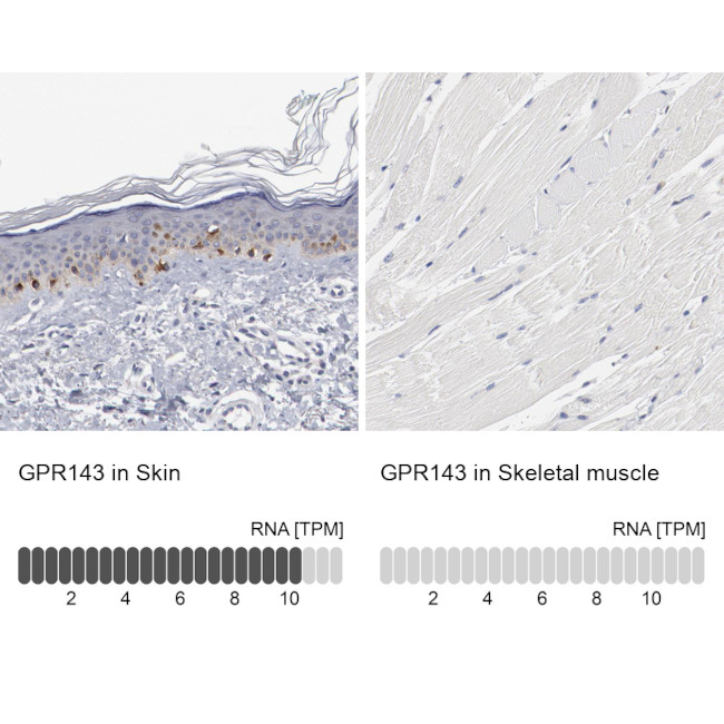 GPR143 Antibody in Immunohistochemistry (IHC)