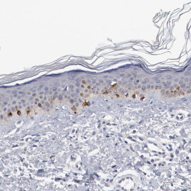 GPR143 Antibody in Immunohistochemistry (IHC)