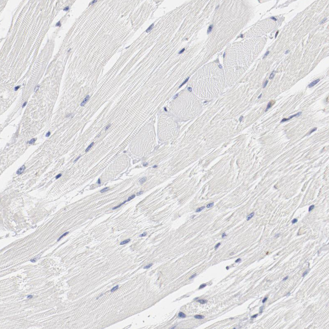 GPR143 Antibody in Immunohistochemistry (IHC)