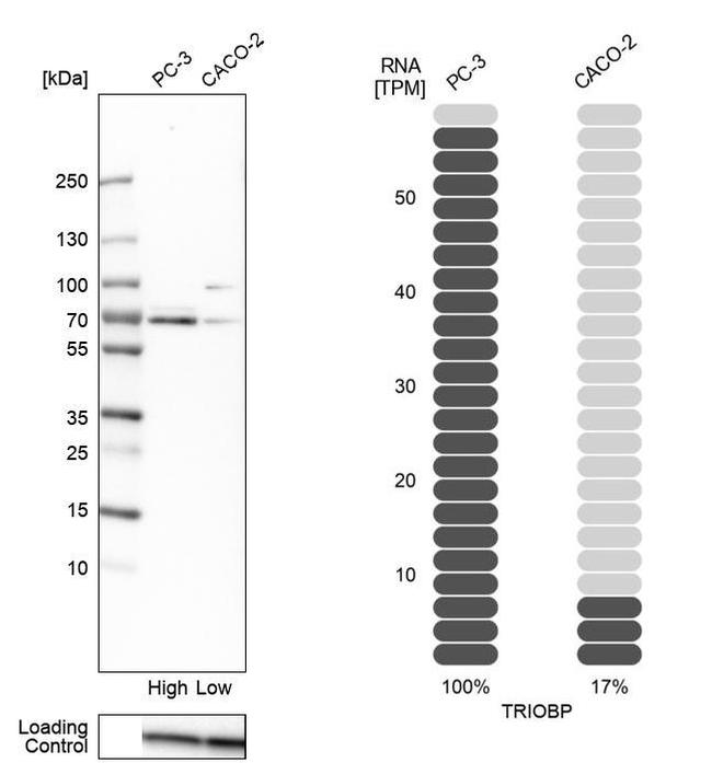 Tara Antibody in Western Blot (WB)