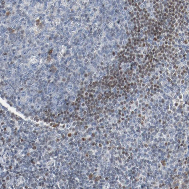 FOXP1 Antibody in Immunohistochemistry (IHC)