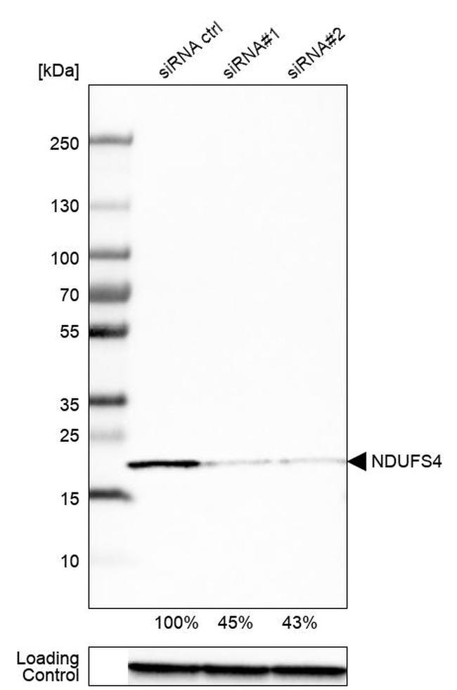 NDUFS4 Antibody in Western Blot (WB)