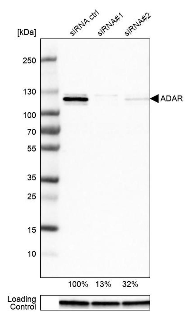 ADAR Antibody in Western Blot (WB)