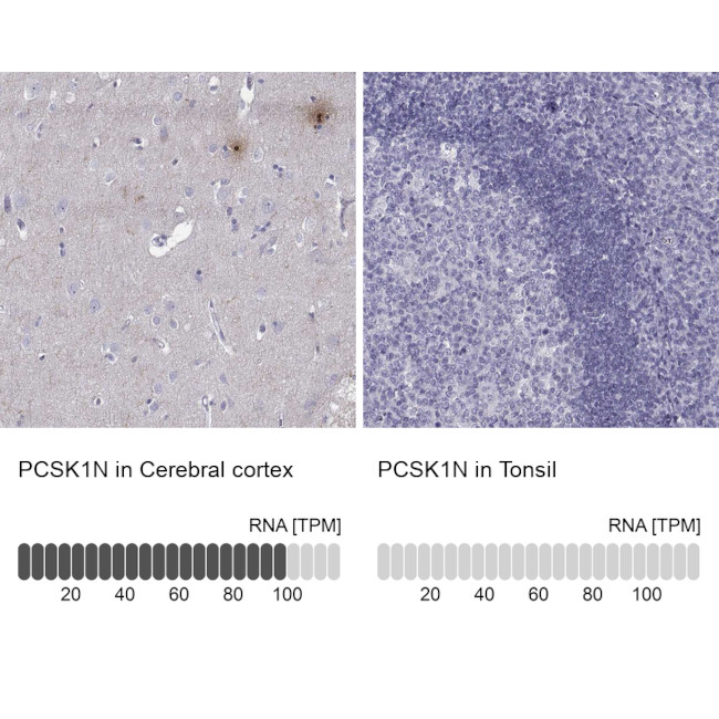 PCSK1N Antibody in Immunohistochemistry (IHC)