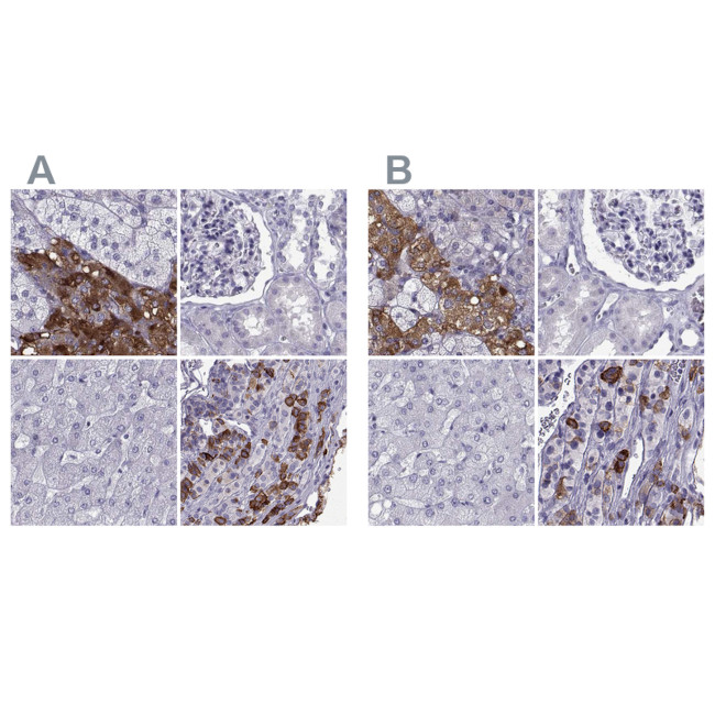 PCSK1N Antibody in Immunohistochemistry (IHC)