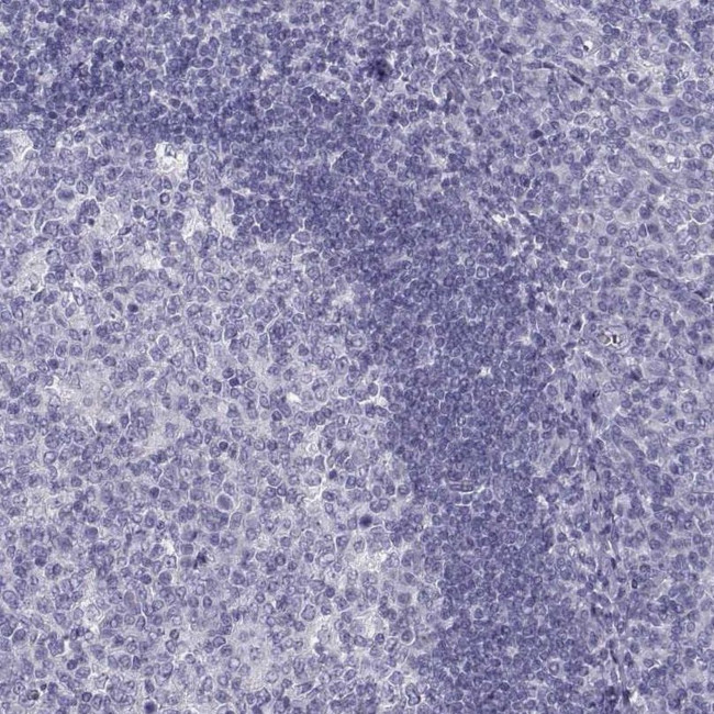 PCSK1N Antibody in Immunohistochemistry (IHC)