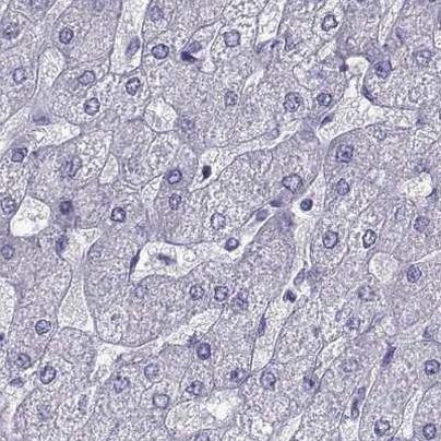 PCSK1N Antibody in Immunohistochemistry (IHC)