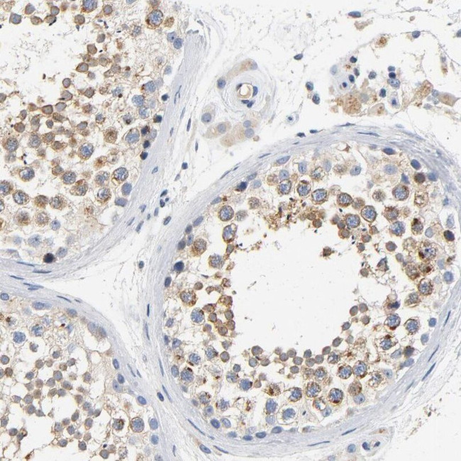 VIP36 Antibody in Immunohistochemistry (IHC)