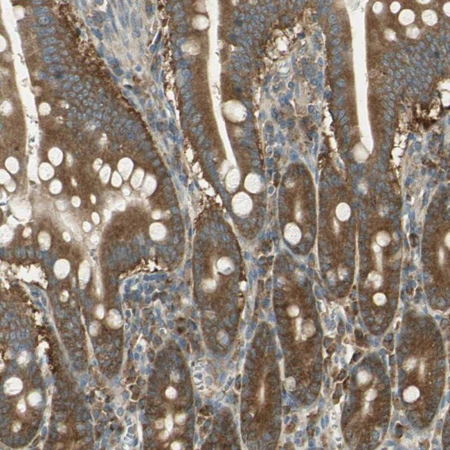 RARS Antibody in Immunohistochemistry (IHC)