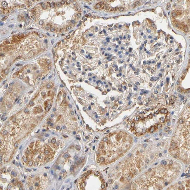 PKN1 Antibody in Immunohistochemistry (IHC)