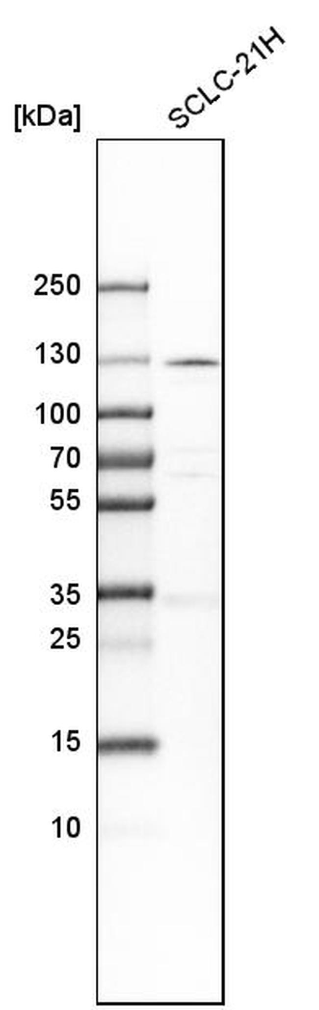 PKN1 Antibody in Western Blot (WB)