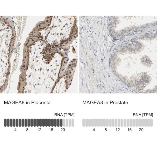 MAGEA8 Antibody in Immunohistochemistry (IHC)