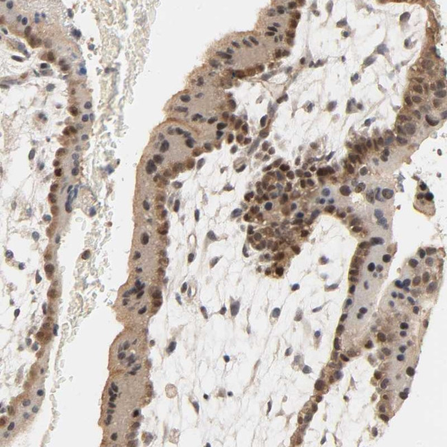 MAGEA8 Antibody in Immunohistochemistry (IHC)