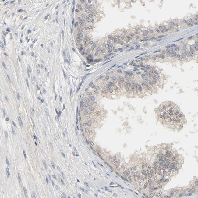 MAGEA8 Antibody in Immunohistochemistry (IHC)