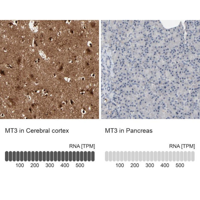 MT3 Antibody in Immunohistochemistry (IHC)