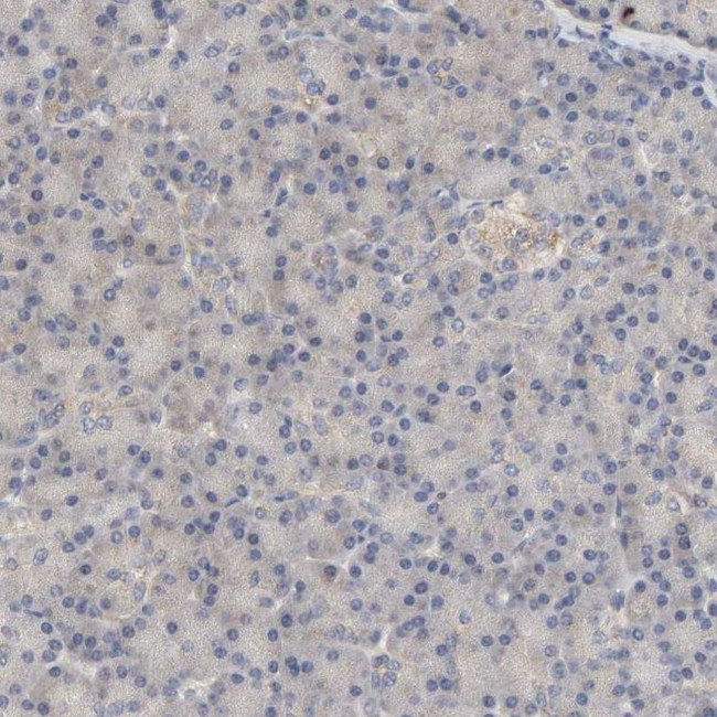 PYGL Antibody in Immunohistochemistry (IHC)