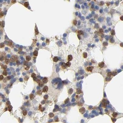 PYGL Antibody in Immunohistochemistry (IHC)