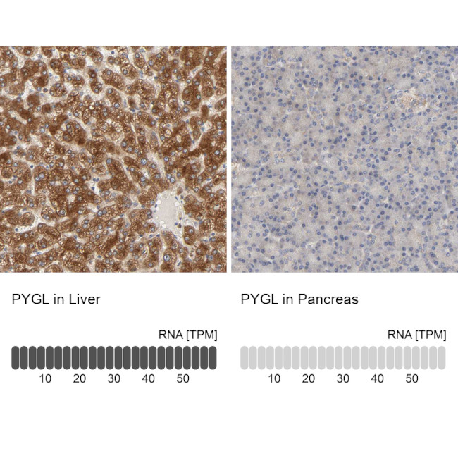 PYGL Antibody