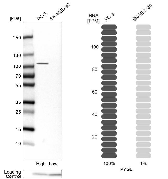 PYGL Antibody