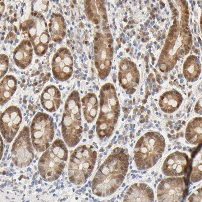 ACSS2 Antibody in Immunohistochemistry (IHC)