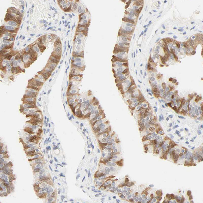 ACSS2 Antibody in Immunohistochemistry (IHC)