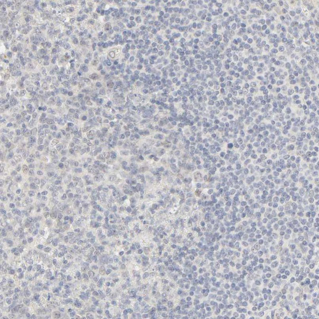 ACSS2 Antibody in Immunohistochemistry (IHC)