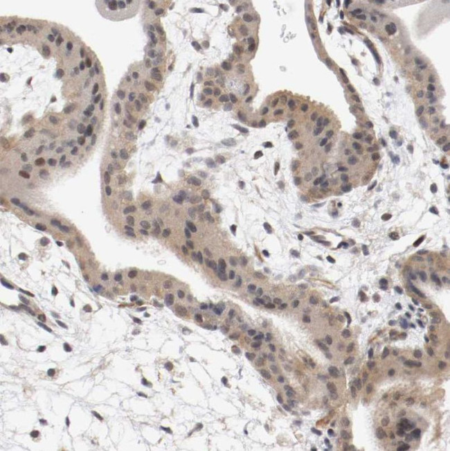 RBM23 Antibody in Immunohistochemistry (IHC)