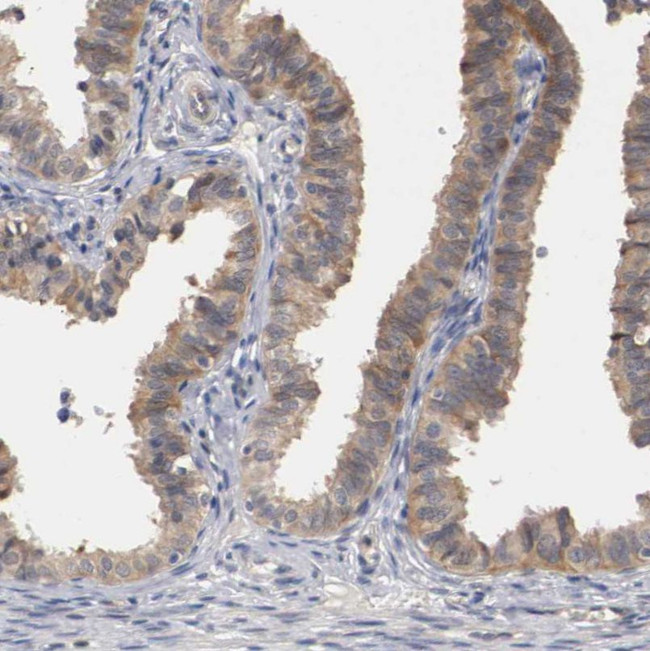 RBM23 Antibody in Immunohistochemistry (IHC)