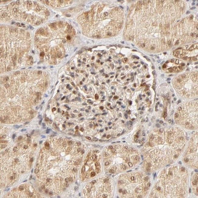 TAF10 Antibody in Immunohistochemistry (IHC)