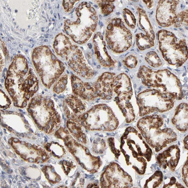 AUH Antibody in Immunohistochemistry (IHC)